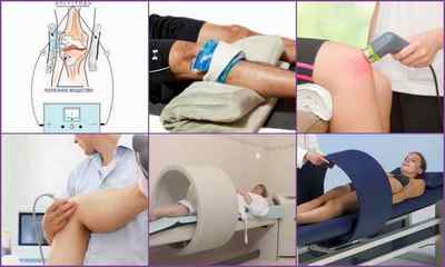Фізіопроцедури при артрозі колінного суглоба: електрофорез, ультразвук, магнітотерапія, лазер, грязелікування