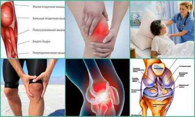 Хвороба Гоффа колінного суглоба: причини, симптоми, лікування