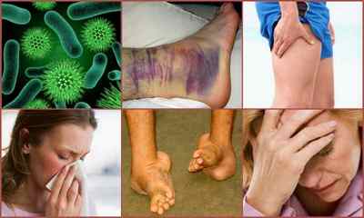 Хвороби суглобів: як називаються, класифікація, причини, симптоми, профілактика