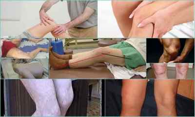 Контрактура колінного суглоба: види, причини, симптоми, лікування