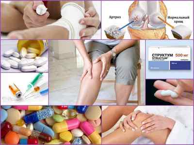 Кращі ліки від артриту і артрозу: таблетки, мазі, уколи