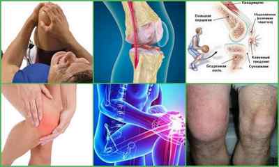 Лігаментит звязок колінного суглоба: причини, симптоми, лікування