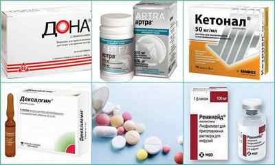 Ліки від артриту суглобів - лікування сучасними медикаментами, список ефективних препаратів