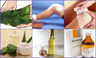 Лікування артриту колінного суглоба народними засобами - перевірені рецепти