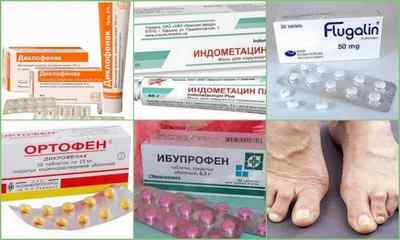 Лікування поліартриту - медикаменти та народні засоби