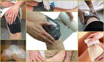 Лікування суглобів глиною в домашніх умовах: корисні властивості, рецепти, протипоказання