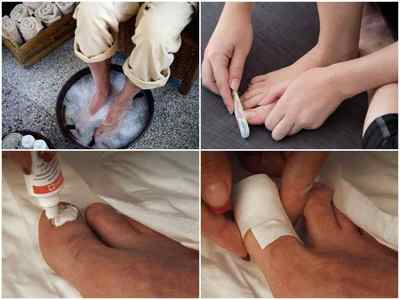 МІКОСТОП крем для ніг і паста для нігтів: інструкція із застосування, склад, ціна, відгуки, аналоги