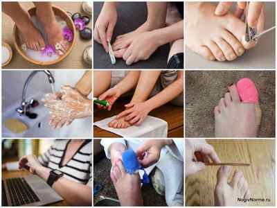 Набір Микоспор для лікування нігтів: інструкція із застосування, ціна, відгуки, аналоги