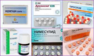 Нестероїдні протизапальні препарати для лікування суглобів (таблетки, мазі, уколи): опис, ціна, отзивиtitle