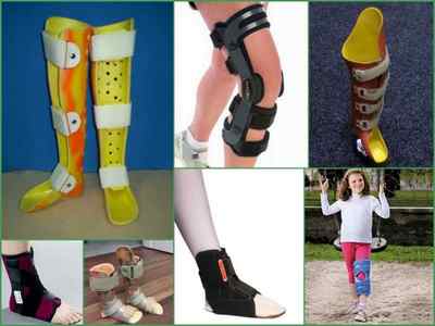 Ортопедичні устілки при вальгусной деформації стопи у дітей і дорослих - як вибрати, відгуки