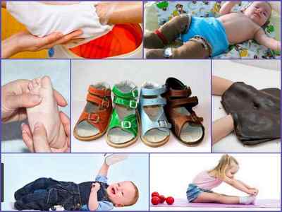 Ортопедичне взуття для дітей при вальгусной деформації стопи - як вибрати, відгуки