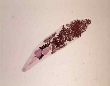 Плоскі глисти: особливості плоских хробаків паразитів у людини