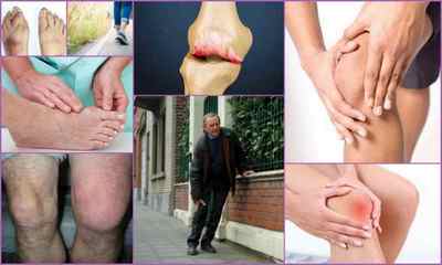Поліартроз суглобів: причини, симптоми, лікування