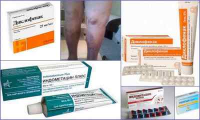 Препарати для лікування венозної недостатності нижніх кінцівок: опис мазей, таблеток, відгуки