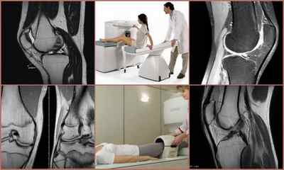 Рентген, МРТ або УЗД колінного суглоба - що краще