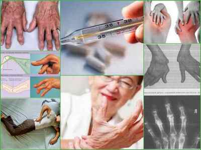 Ревматичний артрит і ревматоїдний артрит - відмінності, особливості симптоматики і лікування