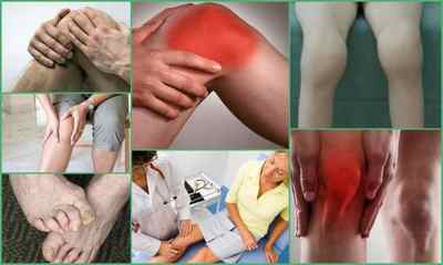 Серонегативний ревматоїдний артрит (поліартрит): причини, симптоми, лікування