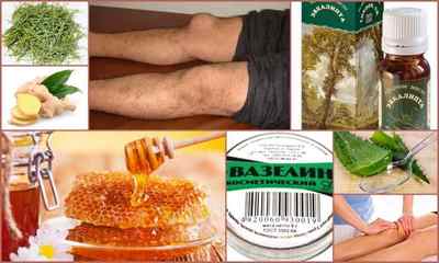 Супрапателлярний бурсит колінного суглоба - симптоми і лікування