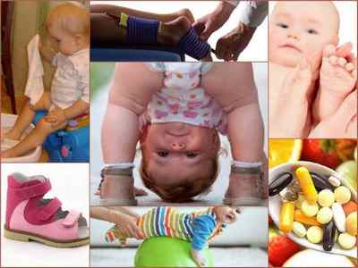 Вальгусное плоскостопість у дітей і дорослих - фото, лікування