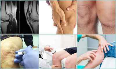 Які бувають хвороби колінного суглоба - симптоми, діагностика, методи лікування