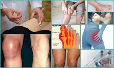 Знеболюючі уколи при болях в суглобах: назви препаратів, опис, відгуки