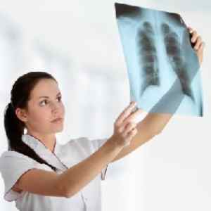 Торакалгія на тлі остеохондрозу грудного відділу хребта | Ревматолог