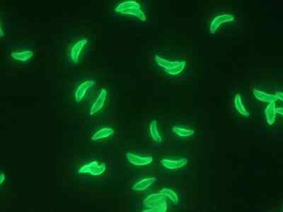 Toxoplasma gondii: що це значить, якщо виявлені антитіла класу g до токсоплазми