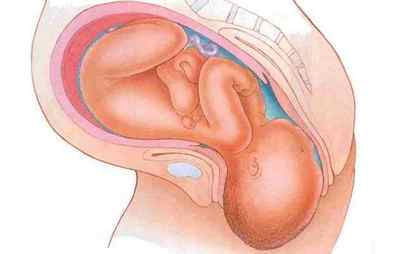 Трихомоніаз при вагітності: причини, лікування, симптоми, наслідки