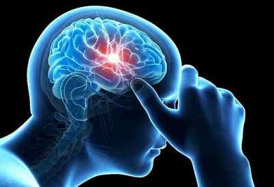 Тромбоз синуса головного мозку