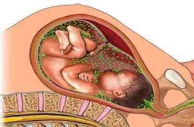 Туберкульоз і вагітність: особливості лікування, можливі наслідки