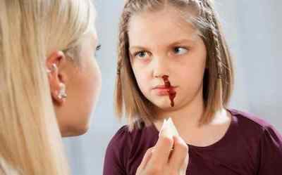 У дитини йде кров з носа - причини і що робити