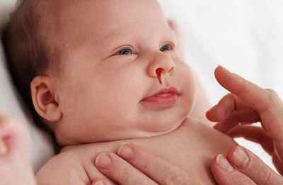 У дитини йде кров з носа - причини і що робити