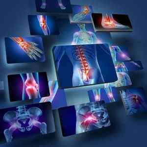 Ударно-хвильова терапія колінного і плечового суглоба, при грижі хребта: відгуки та лікування | Ревматолог