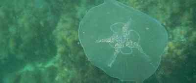Укус медузи: як виглядає опік і що робити, якщо вжалила