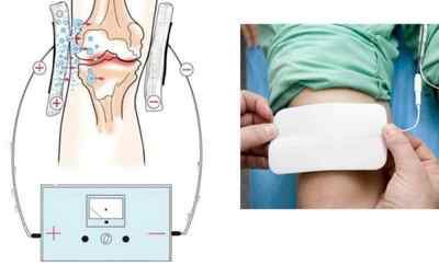 Ультразвук з гідрокортизоном при захворюванні суглобів: відгуки, лікування і протипоказання | Ревматолог