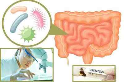 Умовно-патогенна мікрофлора кишечника: поняття, норма і патологія
