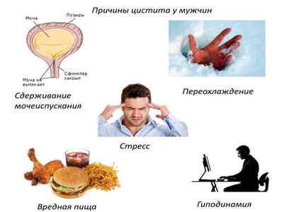 Уреаплазма парвум і цистит: симптоми і лікування