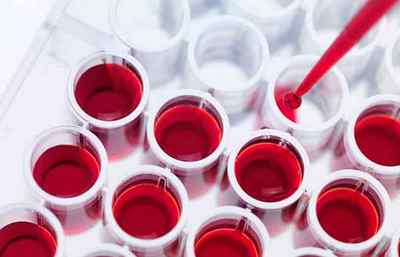 Уреаплазма в крові: аналіз на антитіла у чоловіків і жінок