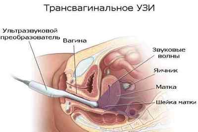 УЗД кишечника: суть процедури, підготовка і проведення