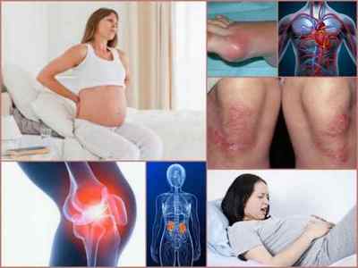 Вагітність і ревматоїдний артрит - прогноз, спостереження, методи терапії