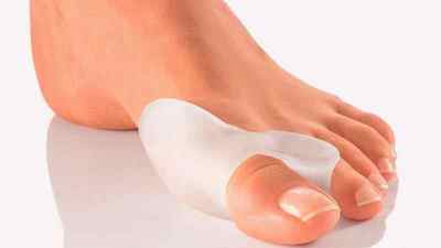Вальгусна деформація стопи: ортопедичне взуття для дітей, лікування халюс вальгус великого пальця стопи у дорослих, операція | Ревматолог