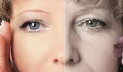 Від чого шкіра повік у жінок різко старіє і чому зявляються зморшки під очима? Поради як запобігти їх освіту