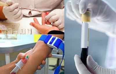 Відмінність клінічного аналізу крові та біохімії