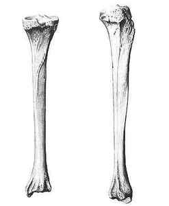 Великогомілкова кістка: анатомія, види переломів, лікування
