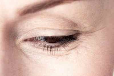 Вибір ефективного засобу проти вікових змін: крем від зморшок навколо очей від 25 років