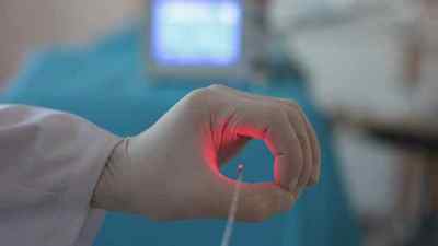 Видалення геморою лазером, плюси лазерного лікування, операція і реабілітація