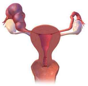 Видалення маткової труби (тубектомія): операція, показання, наслідки