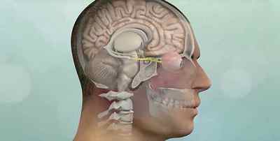 Видалення менінгіоми головного мозку (операція)