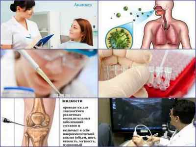 Види артритів: які бувають, класифікація різновидів, діагностика
