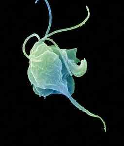 Види паразитів в організмі людини: фото і класифікація назв